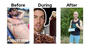 Ryan Kearns' Lyme disease recovery journey shown in three stages. Left: Ryan at the beach in August 2016 with a Lyme disease rash on his chest. Center: holding a jar of herbal tincture during his natural treatment. Right: healthy and fit, smiling and holding a LymeWars box in front of greenery.